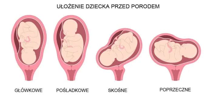 Kiedy dziecko obraca się główką w dół? Poznaj kluczowe informacje